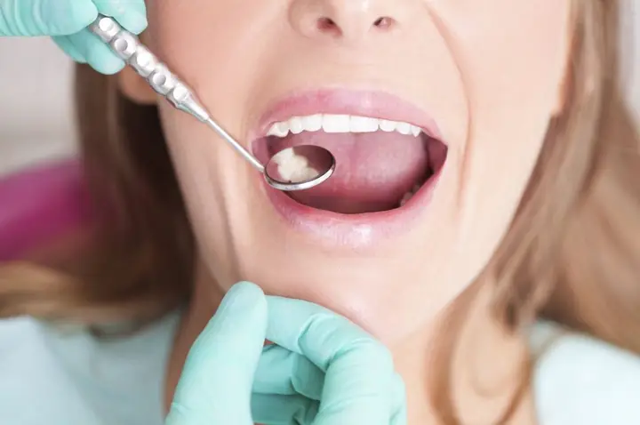 Trồng Răng Sứ: Quy Trình Chi Tiết, Các Phương Pháp Và Lưu Ý Quan Trọng Trồng Răng Sứ: Quy Trình Chi Tiết, Các Phương Pháp Và Lưu Ý Quan Trọng