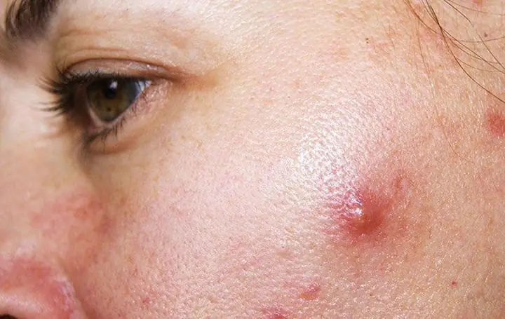 Cách Trồng Cây Chó Đẻ Răng Cưa: Hướng Dẫn Chi Tiết Từ Chăm Sóc Đất Đến Thu Hoạch